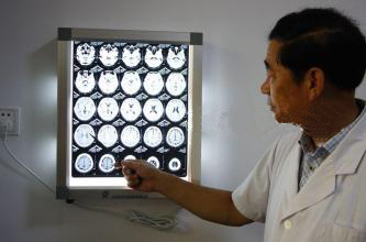 醫(yī)生閱片 醫(yī)生閱片